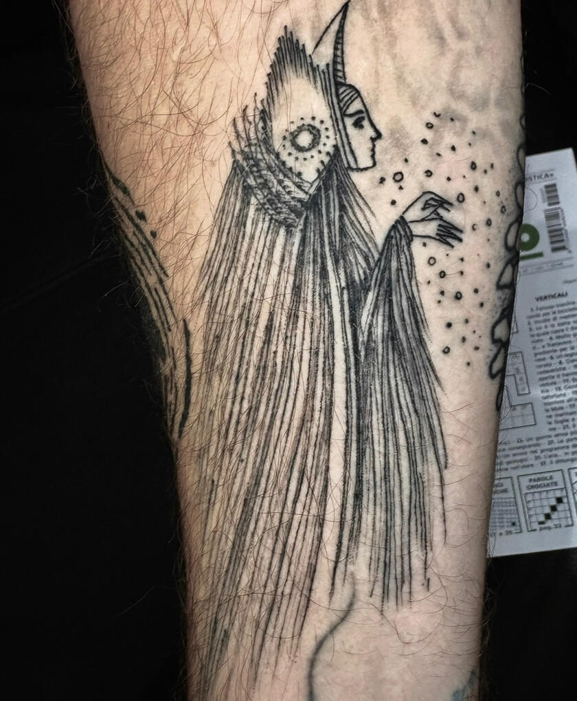 Single needle healed Single needle healed
